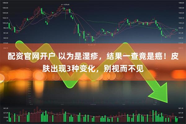配资官网开户 以为是湿疹，结果一查竟是癌！皮肤出现3种变化，别视而不见